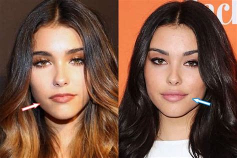 Madison Beer Plastic Surgery: Quotes, Before, After。